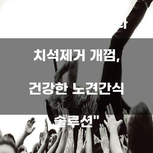 강아지 덴탈껌과 치석제거 개껌, 건강한 노견간식 솔루션