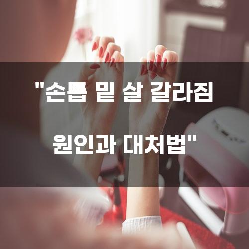 손톱 밑 살 갈라짐 원인과 대처법