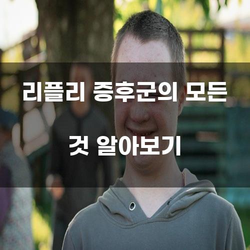 리플리 증후군의 모든 것 알아보기