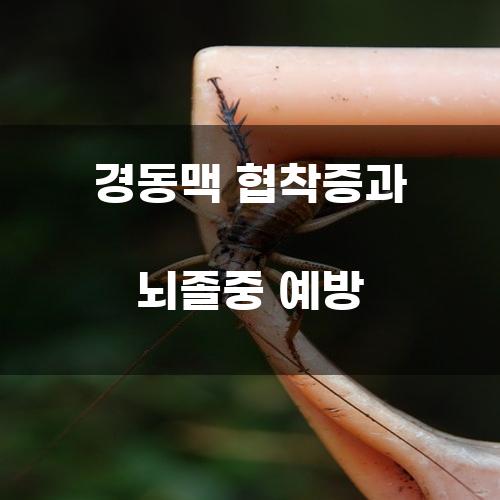 경동맥 협착증과 뇌졸중 예방