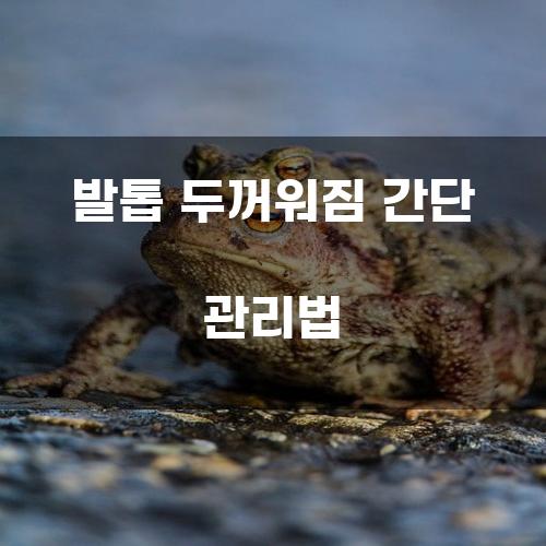 발톱 두꺼워짐 간단 관리법